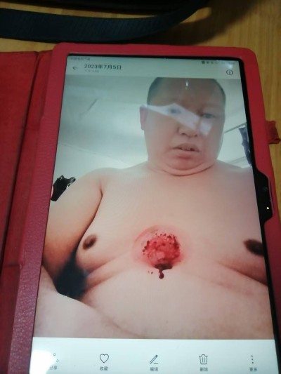 关于《五脏六腑》中医药技术修复