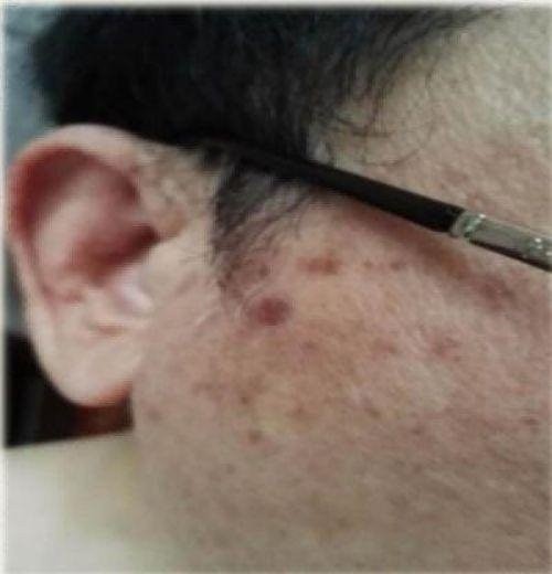 量子氢氧健康第一人长寿哥(廖永贵)  让科学量氢氧品牌走向世界!