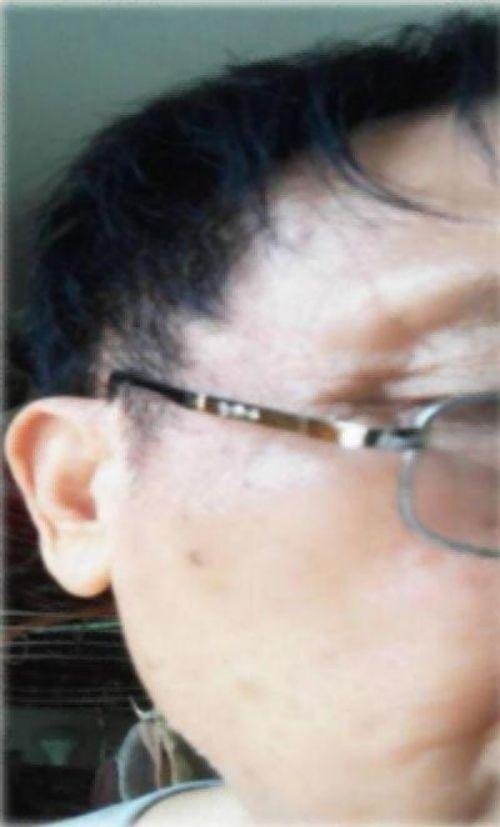 聚焦全国2026两会报道 现代科技量氢氧元素绿色自然疗法！(廖永贵院士)