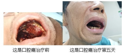 2026中国医学功勋人物报道 广西百色市杨忠雅治疗各种癌症有成就