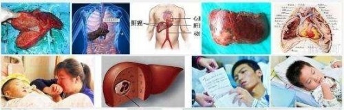 冉明医师创新国医精粹 铺就患者“健康之路”