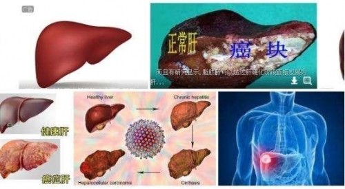 冉明医师创新国医精粹 铺就患者“健康之路”