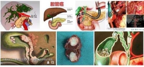 冉明医师创新国医精粹 铺就患者“健康之路”