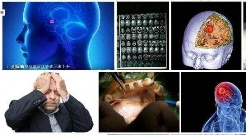 冉明医师创新国医精粹 铺就患者“健康之路”