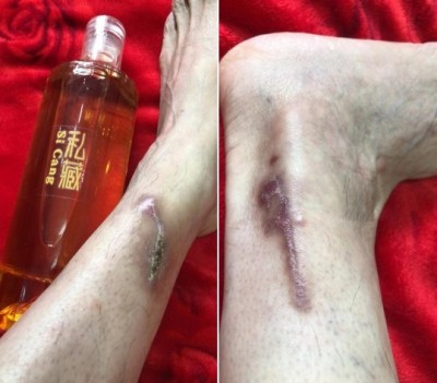 道医脉络学现代疗法创始人——国医名师杨忠